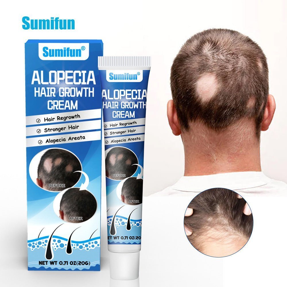 "Alopécie chez l'homme et la femme : causes, types et traitements efficaces" - Beshariel Beauty