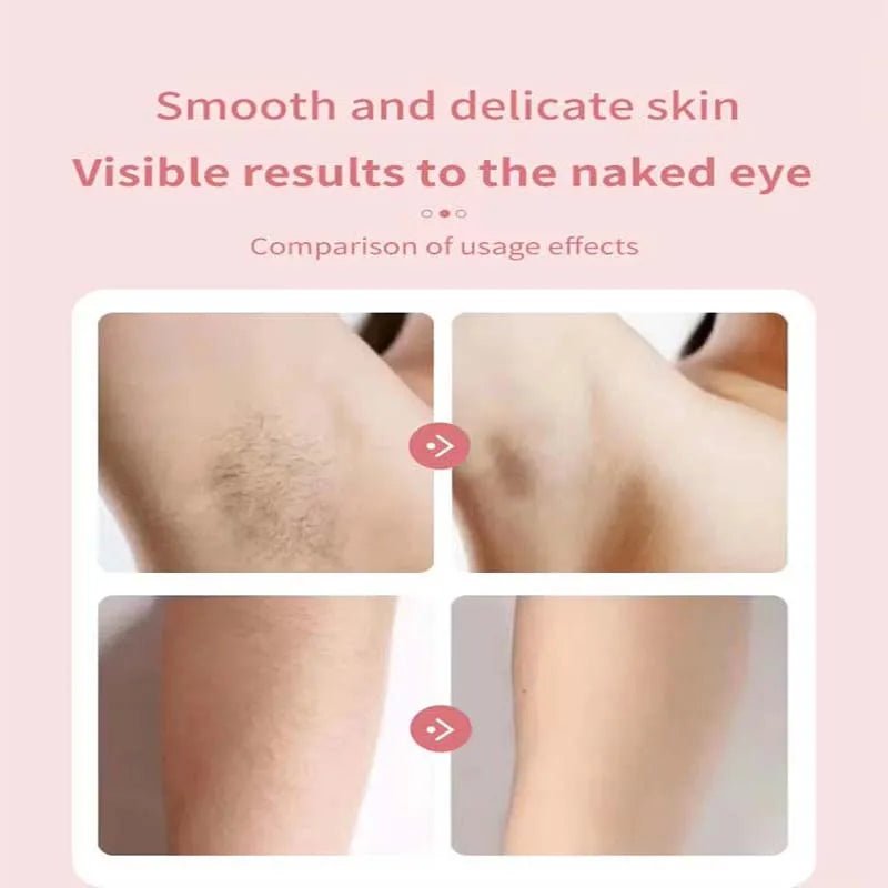 Instrument d'Épilation Électrique 2 en 1 - Professionnel - Beshariel Beauty