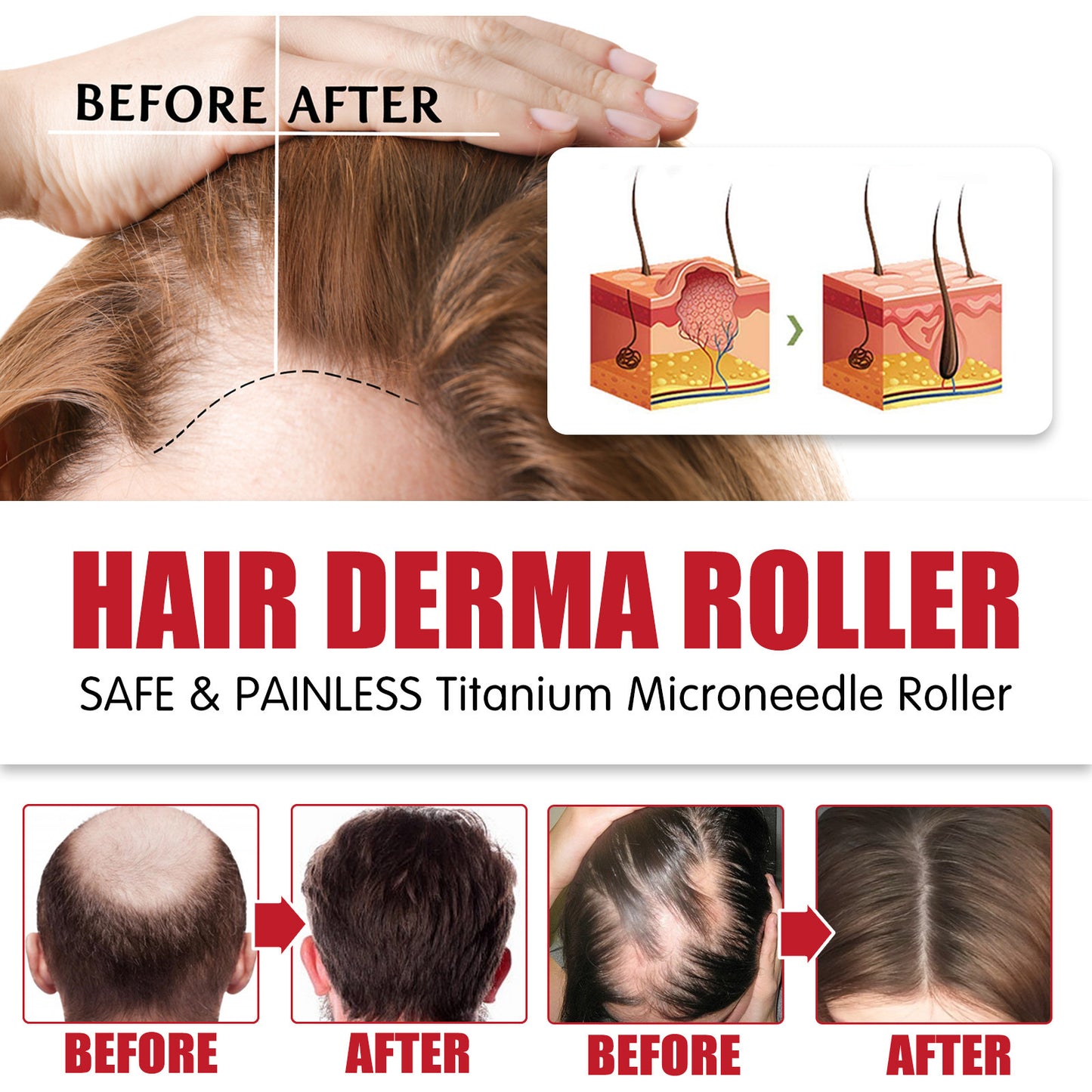 Rouleau Massant Cuir Chevelu – Stimulation & Repousse | Hair Massage Roller - Beshariel Beauty