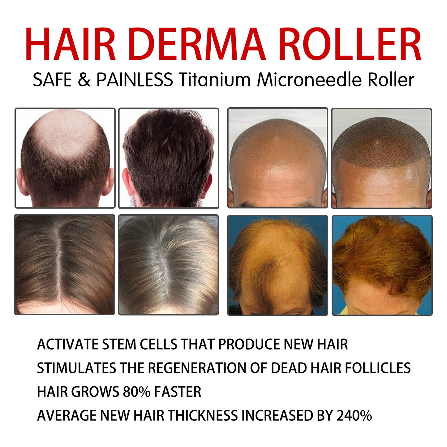 Rouleau Massant Cuir Chevelu – Stimulation & Repousse | Hair Massage Roller - Beshariel Beauty
