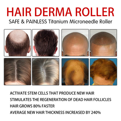 Rouleau Massant Cuir Chevelu – Stimulation & Repousse | Hair Massage Roller - Beshariel Beauty